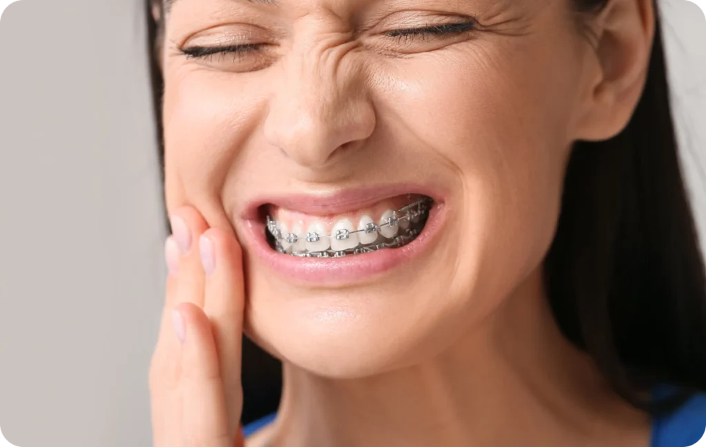 appareils dentaires metal decines charpieu alignement Après la pose d’un appareil dentaire Dentistes à Décines-Charpieu, Cabinet dentaire Grand Large