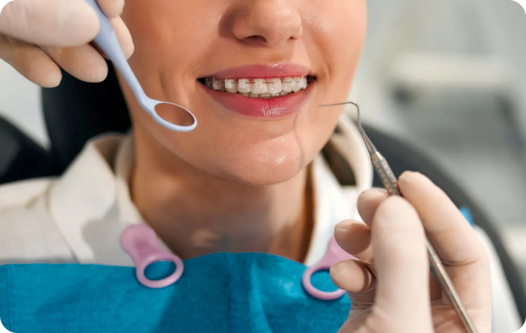 appareils dentaires metal decines charpieu correction Après la pose d’un appareil dentaire Dentistes à Décines-Charpieu, Cabinet dentaire Grand Large