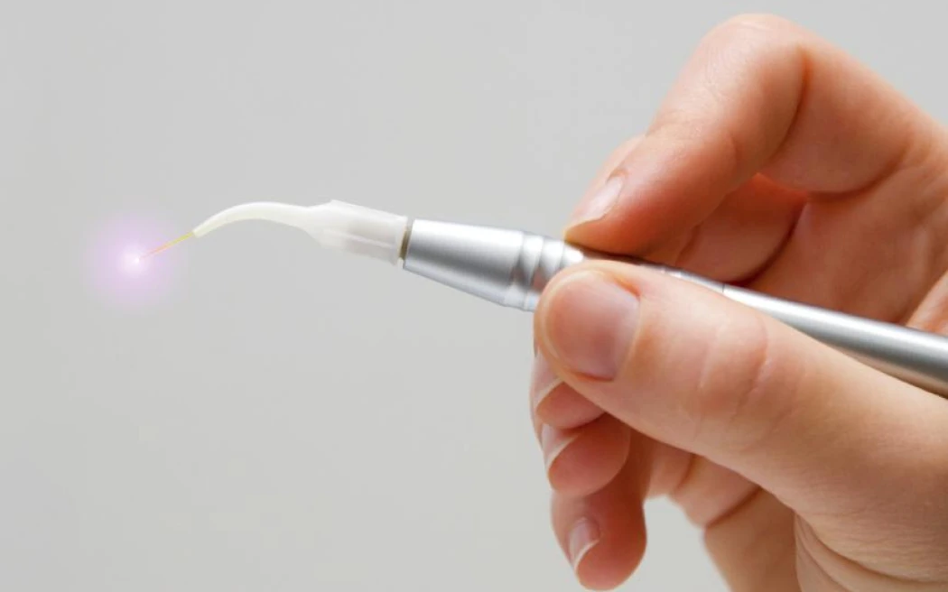 correction dentaire decines charpieu orthodontique Technologies Dentistes à Décines-Charpieu, Cabinet dentaire Grand Large