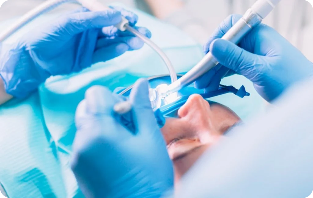 chirurgie dentaire charpieu esthetique Extraction dentaire Dentistes à Décines-Charpieu, Cabinet dentaire Grand Large