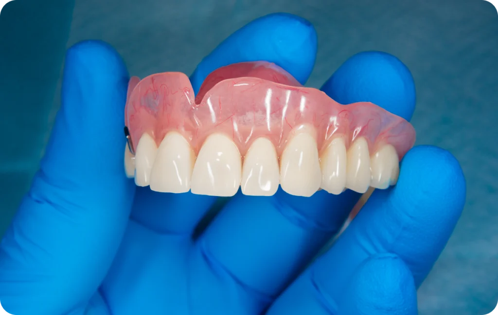 prothese sur implant decines charpieu esthetique Prothèses dentaires amovibles Dentistes à Décines-Charpieu, Cabinet dentaire Grand Large